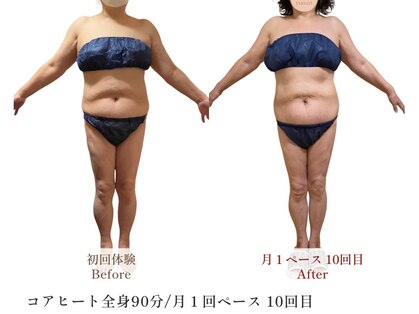 コアヒート専門温活エステサロン yunari 【ユナリ】の写真