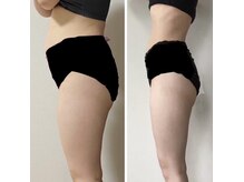 サロン ラニ(Salon Lani)の雰囲気（デトックス♪飲むだけ☆健康でこそダイエットが出来る身体に。）