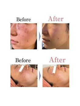 銀座ナチュラル スタイル (Natural Style)/フェイシャル/毛穴/整体