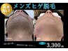 【新規限定】ヒゲ脱毛|青ヒゲすっきり!毎朝がラクに!|30分| 通常¥4,400→