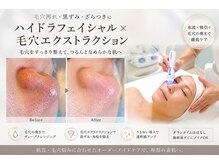 アベニール(AveniR)の雰囲気（ハイドロフェイシャル＆毛穴エクストラクション）