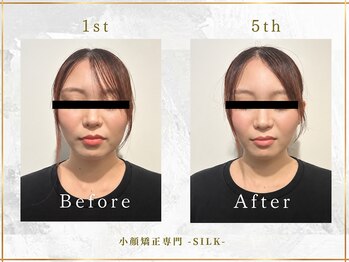 シルク(SILK)の写真/【SILK式小顔・歪み矯正を受けると？】「顔のお悩み改善」「小顔・姿勢改善」「体の不調改善」３つの効果◎