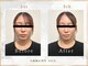 シルク(SILK)の写真/【SILK式小顔・歪み矯正を受けると？】「顔のお悩み改善」「小顔・姿勢改善」「体の不調改善」３つの効果◎