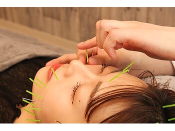 ジェン(gen)/美容鍼