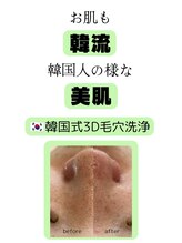 ラデュープラス(Radieux+)/韓国式3D毛穴洗浄