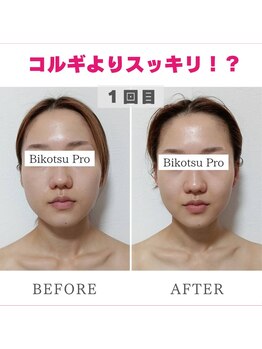ビコツプロ(Bikotsu Pro)/たった30分でむくみスッキリ！