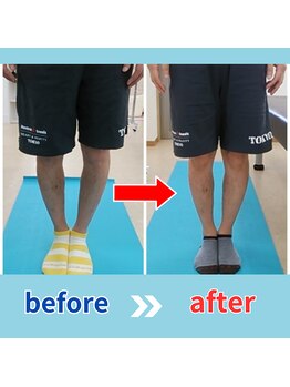 ストレッチヒーロー 鳥取店(STRETCH HERO)/O脚/X脚