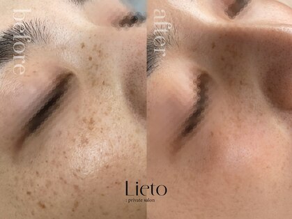 リエイト(Lieto)の写真