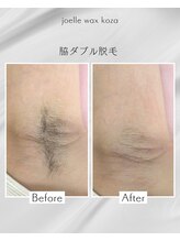 ジョエルワックス 沖縄コザ店(JOELLE WAX)/脇ダブル脱毛☆
