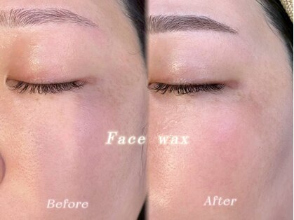 ユーアイ(Yu_eye)の写真