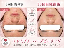 エンクリニカルラボ 京都駅前店(E&N CLINICAL LABO)