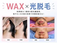 アルゴ 柳川店(ALGO)の雰囲気（WAXと光の併用可！お客様満足度No１♪）