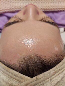 キアラ 麻布十番(Kiara)/顔脱毛　の仕上がり