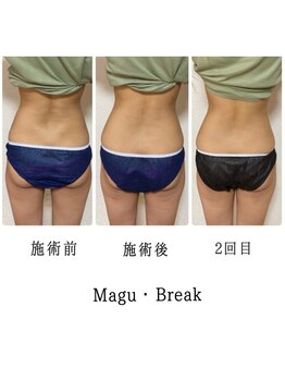 アイラッシュ ラピス(Lapis)/マグブレイク