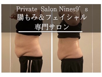 ナインズ(Nines 9'S)/施術例