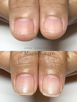 マリーロール 梅田店(Marie Laure)/自爪育成/深爪矯正/ネイルケア