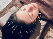 ヘッドサイエンス(HEADSCIENCE)/最強リフトアップ美容鍼
