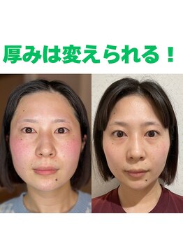 コルギと小顔矯正サロン ウンジョルノ フェリーチェ(un giorno felice)/美肌顔筋&小顔コルギ5回