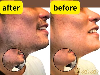 サロンビビ 町田店(Salon BiBi)/ひげもきれいに