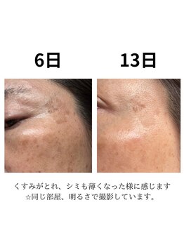 ココユール(cocoyull)/ハーブ蒸し1週間連続チャレンジ