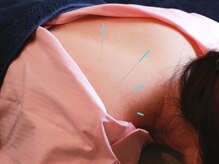 旭堂の雰囲気（鍼施術専用のお着替えをご用意☆リラックスして受けられる施術◎）