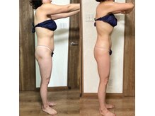 メルシー サロン(Merci Salon)の雰囲気(セルゼロ「痩身」40代5ヶ月で-9kg ウエスト-12cm)