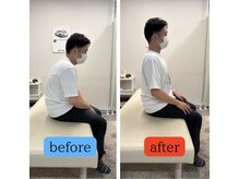 さざれ整体院 大垣店/猫背、巻肩の施術後の変化です！