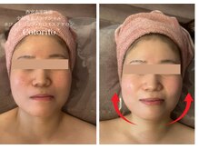 コトリト(Cotorito)/むくみ改善でリフトアップ！！