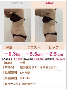 スリムステーション 高槻駅前(Slim Station)/お腹周りを徹底施術！