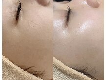 サロンユウ/ツヤ肌リフトエステ