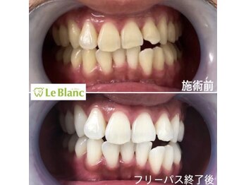 ルブラン 奈良店(Le Blanc)/自然な白さで艶もでる