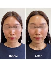 かみしな接骨院/フェイシャル結果