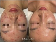 SALON DE Cの雰囲気（肌質改善は根本からの改善を。症例写真はフォトギャラリーへ）