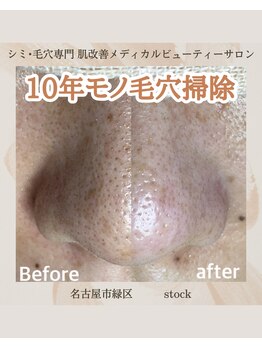 ストック(stock)/