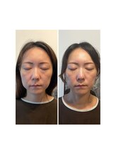 リモド(Rimodo509)/小顔矯正（ヘッドスパ