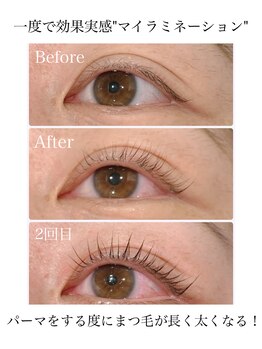 スマートポッシュ(Smart posh)/【マイラミネーション】