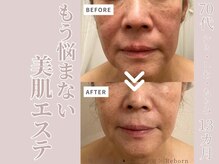 リボーン(Reborn)/70代 エイジングケア(1年1ヶ月)
