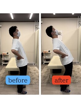 さざれ整体院 大垣店/急な腰の痛みのお客様　