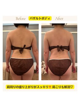 アイシー(I Sea)/首肩こりにも効果大!!