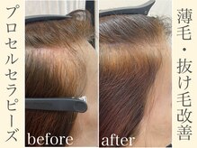 サロン アール(salon AR)/