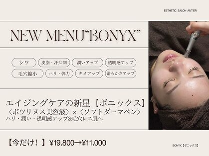 アンティエの写真