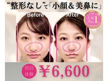 隆鼻矯正専門店 ラプリ(Raplit)/隆鼻＋輪郭矯正10回