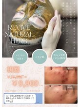 ファイン(Fine)/ハーブピーリング