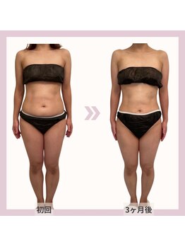 クレーヴ 宇部店(CREVE)/