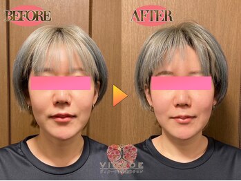 【小顔/リフトアップ/姿勢/骨盤矯正/頭蓋骨/痩身】ヴィオーデ美容整体サロン那覇店/小顔、リンパ、ヘッドスパ、整体