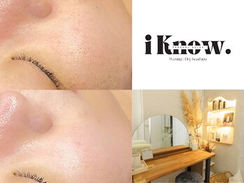 アイノウ(i Know.)の写真/【毛穴の黒ずみ・詰まり・産毛をケア☆】透明感のあるつるんとした毛穴レス肌を目指しませんか?