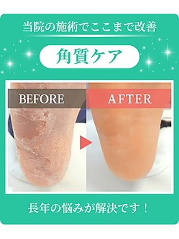 フルフィル 北千住の写真/足の専門店による本格フットケアで、巻き爪や魚の目など足のお悩みを解決へ♪