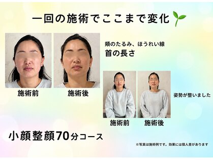Rらっくすの写真