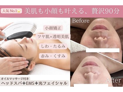 ウミン(UMIN)の写真