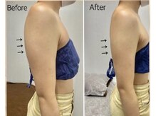 エンチャント(ENCHANT)/むにっと二の腕解消☆